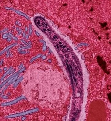 211682067695156910.jpeg 211682067695156910.jpeg